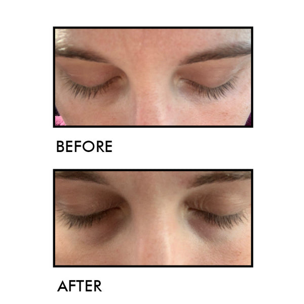 Lash growth result 3