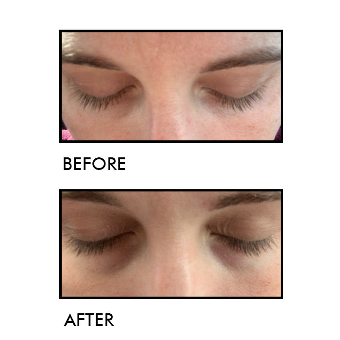 Lash growth result after 12 weeks